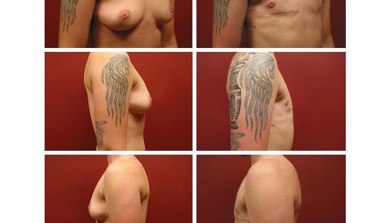 Glamour tattoo mtf saggy tits