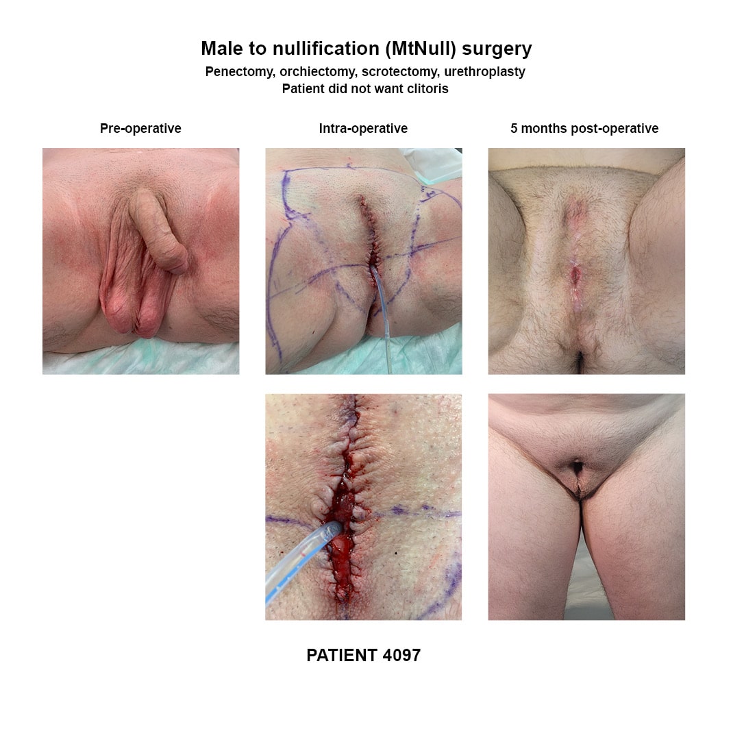 4097_GRS nullification